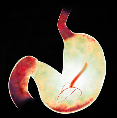 Helicobacter pylori is a gram-negative, flagellated, helical bacterium. It is capable of colonizing the stomach mucosa. 3d renderingの写真素材