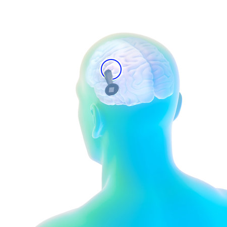 Link, neurallink, new artificial intelligence technology that allows you to connect to the human brain. Neuralink sensors ready to be installed in the skull of a human. 3d renderの写真素材