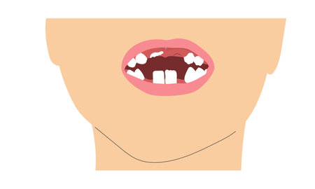 A boy smile missing tooth due to change of milk teeth. Simple minimalistic illustration of baby mouth with incomplete set of teeth.のイラスト素材