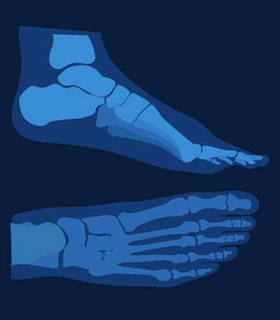 Top and side view of foot bones on x-ray flat drawing.のイラスト素材