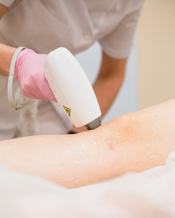 Preparing and conducting a laser hair removal procedure on the skin in a beauty salon - aesthetic medicine for beautyの写真素材