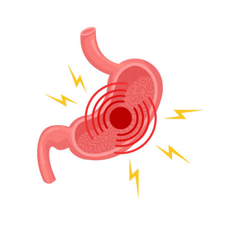 Pain and sick in stomach Gastritis, indigestion and ulcer problems. Vector flat illustration on white backgroundのイラスト素材