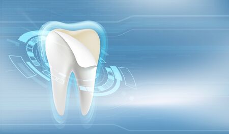 Dental veneers. Tooth whitening and beauty treatment. Vector illustration.のイラスト素材