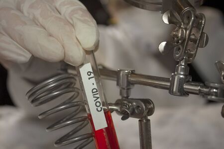 Test tube containing plasma held by the hand of a biotechnological researcher doctor in Mexico city