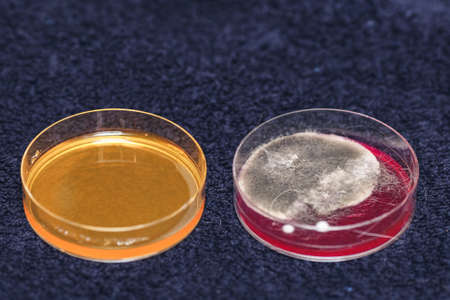 bacterial inoculation in laboratory dishes, grown colonies of bacteria or fungi.の写真素材