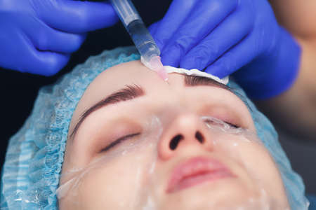 facial mesotherapy for smoothing mimic wrinkles on the forehead. Cosmetologist makes an injection for skin rejuvenation and tightening.の写真素材