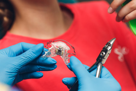 close-up of a dentist preparing braces for a patient.