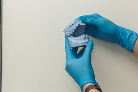 The orthodontist holds in his hands and examines the cast of the jaw.の写真素材