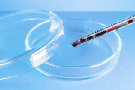 Medical laboratory. The blood from the pipette is poured into an empty Petri dish on a blue background. Laboratory tests. Close-up.の写真素材
