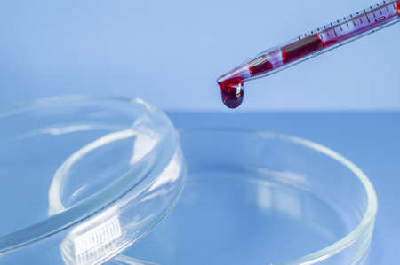 Medical laboratory. The blood from the pipette is poured into an empty Petri dish on a blue background. Laboratory tests. Close-up.の写真素材