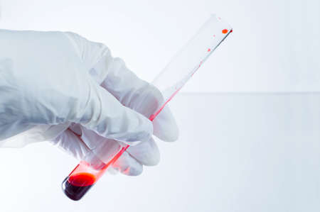 Medical laboratory. A gloved hand holds a test tube of blood on a blue background. Elements of a bitmap drawing. Close-up.の写真素材