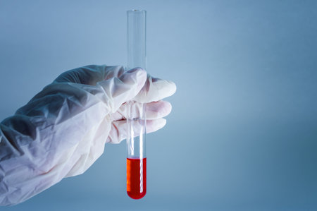 Medical laboratory. A test tube with blood in the hand in a medical glove on a blue background. The concept of laboratory research. Close-up.の写真素材