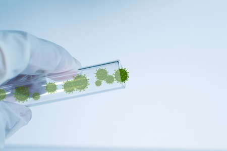 Medicine. A gloved hand holds a test tube containing the virus. Elements of a bitmap drawing. The...