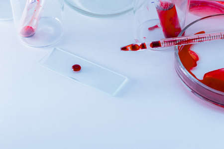Medical laboratory. Test tubes with blood on a white background. The concept of laboratory research....