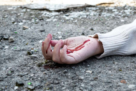 a man's hand in blood lies on the asphalt on the road after a car accident.