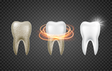 Tooth clean 3d health. Dental realistic dirty whitening. Dentist teeth hygiene isolated medicine template.のイラスト素材
