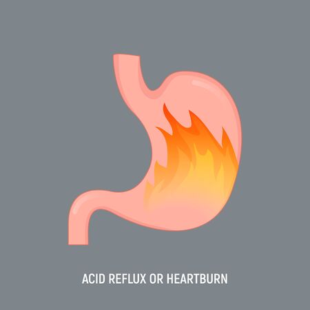 Acid stomach burn gastritis icon. GERD acidity stomach reflux heartburn acheのイラスト素材