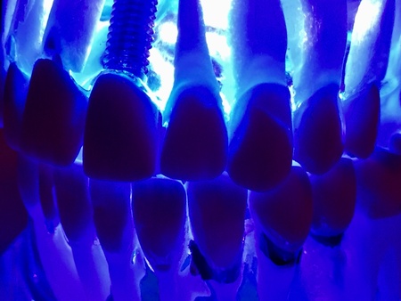 Dental model of teeth under uv lightの素材