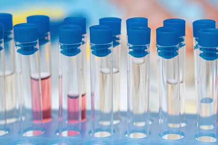 Test tubes in laboratory. Biotechnology, science and research concept.