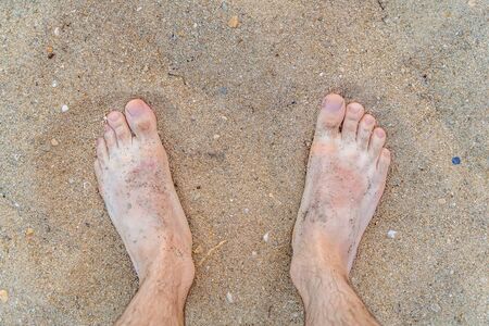 Man's feet on sandy beach at summer.の写真素材