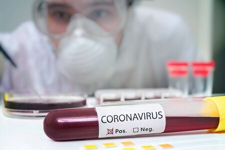 Researcher in laboratory is analyzing blood sample in test tube for Coronavirus test.の写真素材