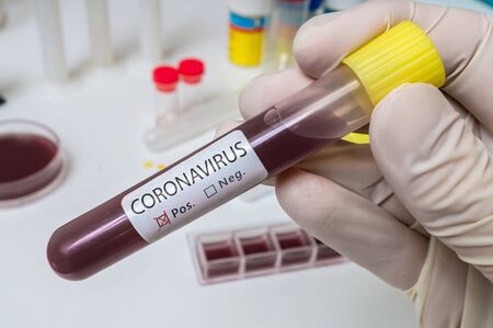 Hand holds test tube for Coronavirus 2019-nCOV analysis.の写真素材