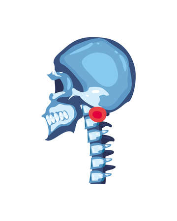 Rheumatology skull bonesのイラスト素材