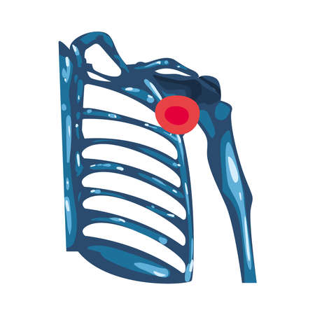 Rheumatology ribs bonesのイラスト素材