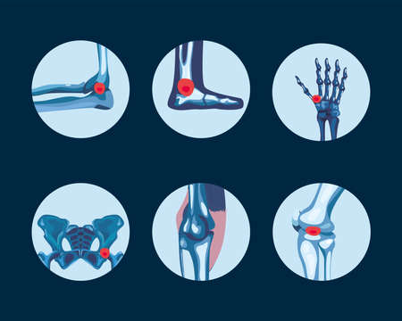 Rheumatology symbol collectionのイラスト素材