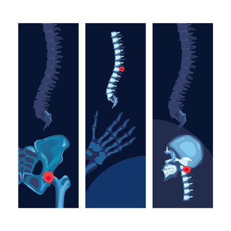 Rheumatology posters setのイラスト素材