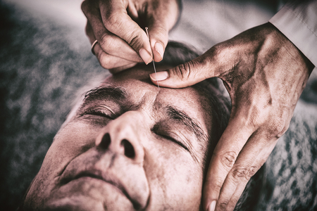 Senior man receiving head massage from physiotherapist in clinicの写真素材