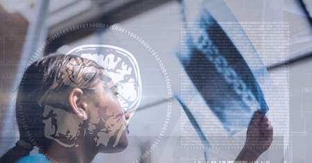 Composition of medical data processing with human brain over female doctor checking x ray. medicine, digital interface and data processing concept digitally generated image.の写真素材