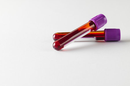 Two blood sample tubes with purple lids, on white background with copy space. Blood health diagnostics, analysis and blood donation.の写真素材