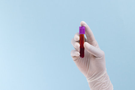 Hand in white surgical glove holding blood sample tube, on blue background with copy space. Blood...