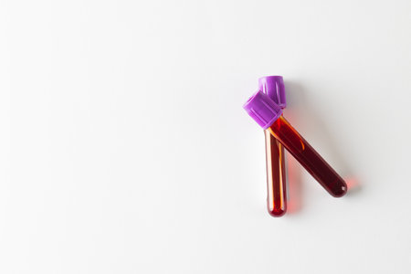 Two blood sample tubes with purple lids, on white background with copy space. Blood health...