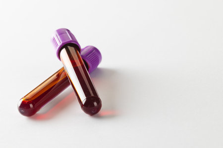 Two blood sample tubes with purple lids, on white background with copy space. Blood health...