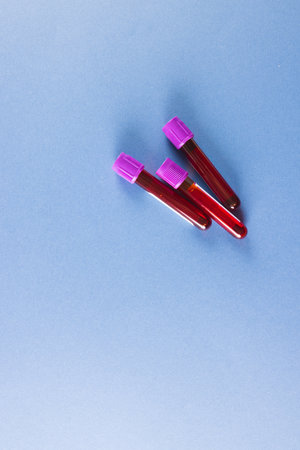 Three blood sample tubes with purple lids, on blue background with copy space. Blood health diagnostics, analysis and blood donation.の写真素材