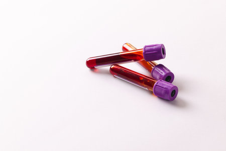 Three blood sample tubes with purple lids, on white background with copy space. Blood health diagnostics, analysis and blood donation.の写真素材