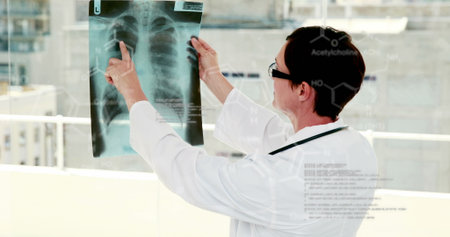 Image of scientific data processing over caucasian female doctor with x ray photo. health, medicine, science and technology concept digitally generated image.の写真素材