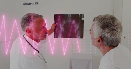 Image of cardiograph over caucasian male doctors holding xray. Medicine, technology and digital interface concept digitally generated image.の写真素材