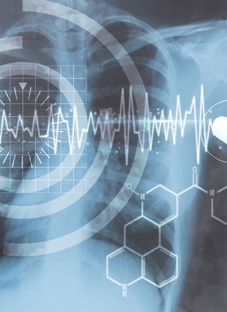 Medical interface on xray