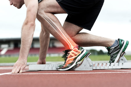 Digital composite of Runner experiencing ankle painの写真素材