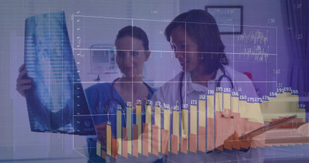 Two medical professionals examining chest X-ray in exam room with 3D bar graph and line chart. Healthcare, diagnostics, analysis, scientific, technological, collaboration, data visualizationの写真素材