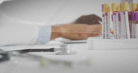 Displaying MONKEYPOX VIRUS test tube rack on lab desk with stethoscope, tablet, copy space. Medical, research, diagnostics, laboratory, clinical, science, healthcareの写真素材