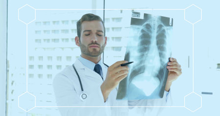 Examining doctor holding chest Xray, pointing with pen by big window in lab coat, tie, stethoscope....