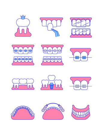 Dental clinic surgery services thin line vector icons. Dental implant, bridge, veneer, crown concepts. Orthodontic treatment such as metal, ceramic, lingual, plastic braces. Removable denture symbolのイラスト素材