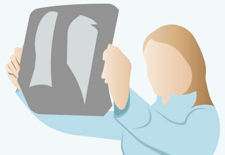 A doctor in a medical gown holds an X ray of a persons lungs in his hand. Healthcare and medical care. Vector illustration on a white background.のイラスト素材