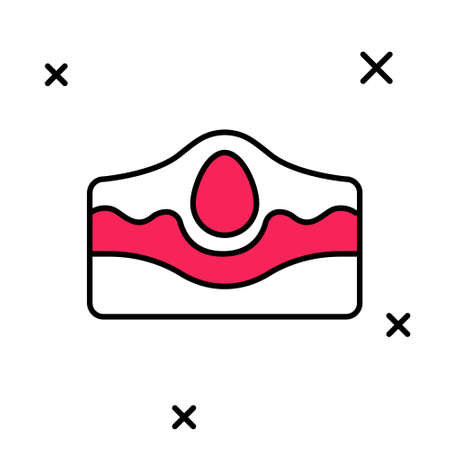 Filled outline Acne icon isolated on white background. Inflamed pimple on the skin. The sebum in the clogged pore promotes the growth of a bacteria. Vectorのイラスト素材