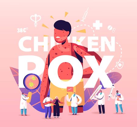Chicken Pox Varicella Concept. Tiny Doctors Characters near Huge Boy with Red Pimples on Body. People Vaccination, Prevention and Immunization Medical Poster Banner Flyer. Cartoon Vector Illustrationのイラスト素材