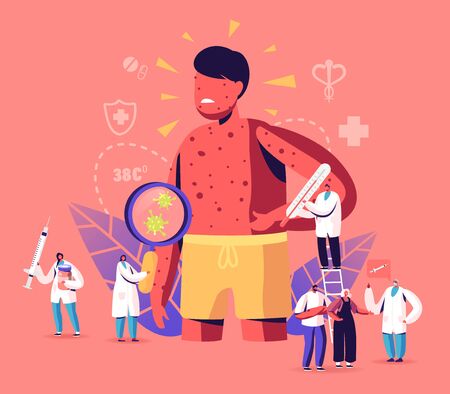 Chicken Pox Varicella Symptoms Concept. Tiny Doctors Characters with Stuff near Huge Boy with Red Pimples on Bodyのイラスト素材